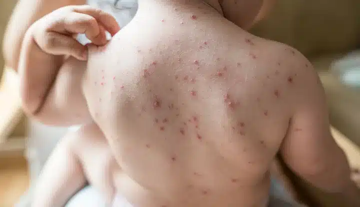 พีคอสเมด Pcosmed ศูนย์รวมโซลูชั่นด้านผิวหนังครบวงจร