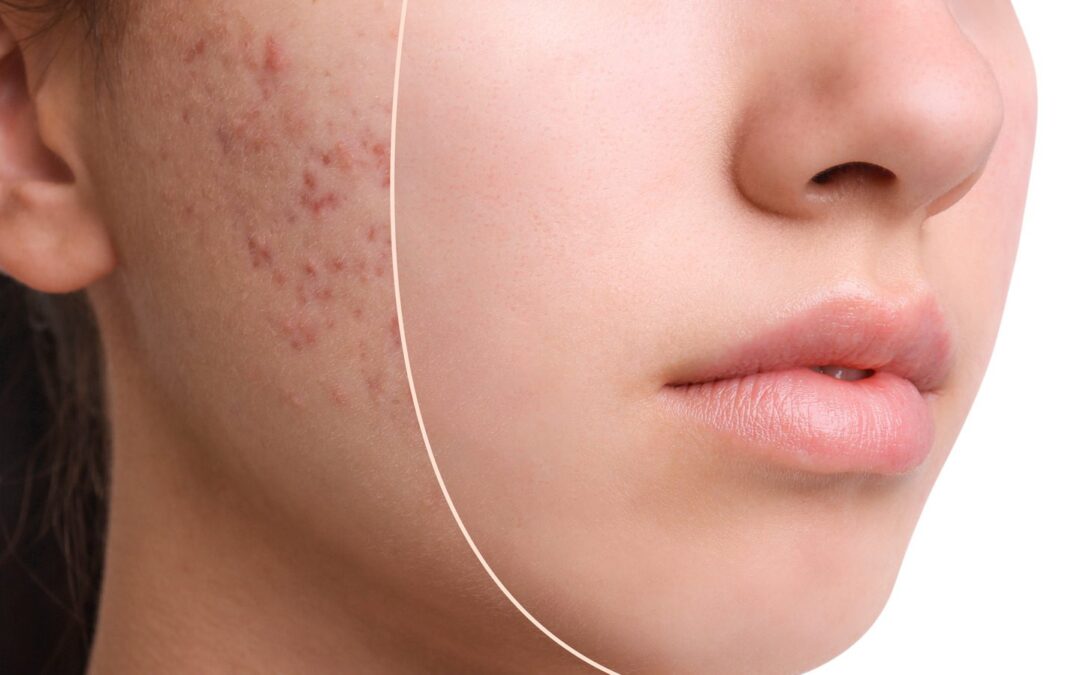 พีคอสเมด Pcosmed ศูนย์รวมโซลูชั่นด้านผิวหนังครบวงจร