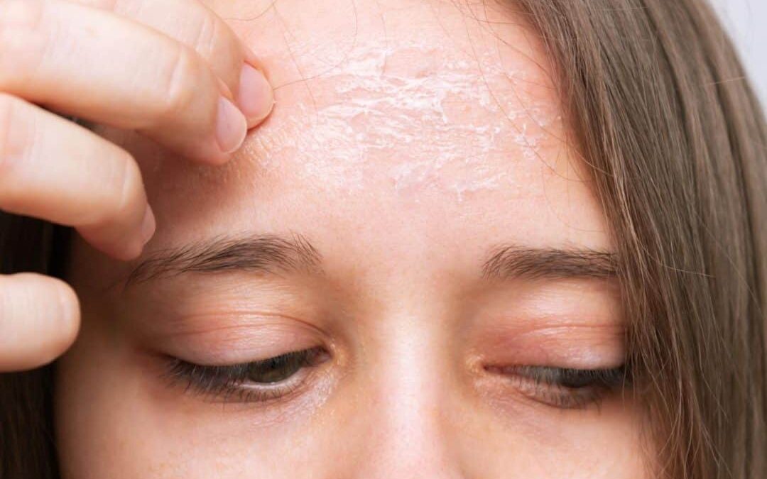 พีคอสเมด Pcosmed ศูนย์รวมโซลูชั่นด้านผิวหนังครบวงจร