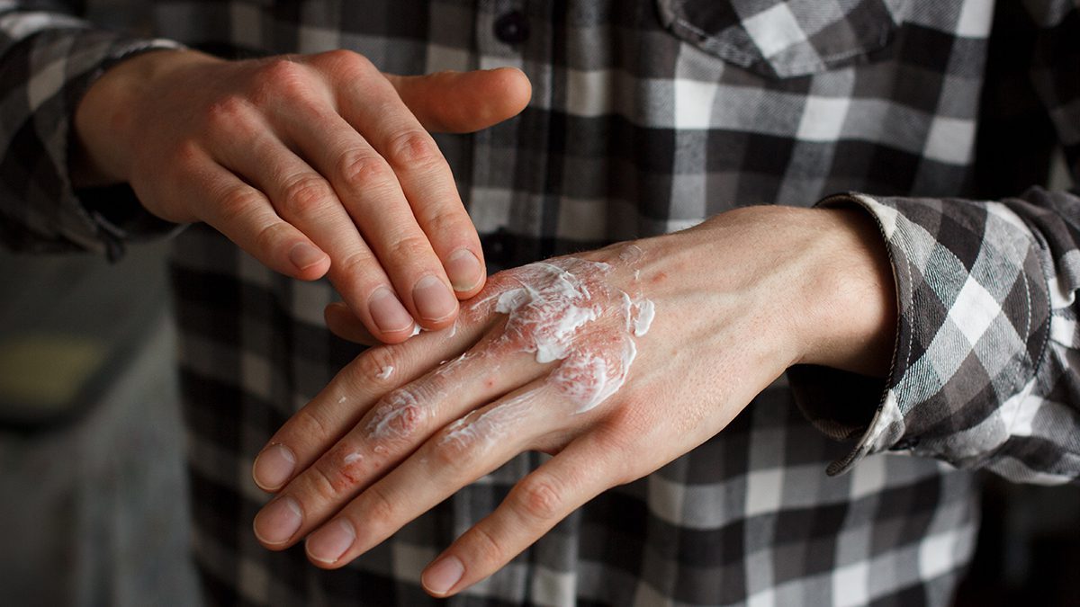 พีคอสเมด Pcosmed ศูนย์รวมโซลูชั่นด้านผิวหนังครบวงจร