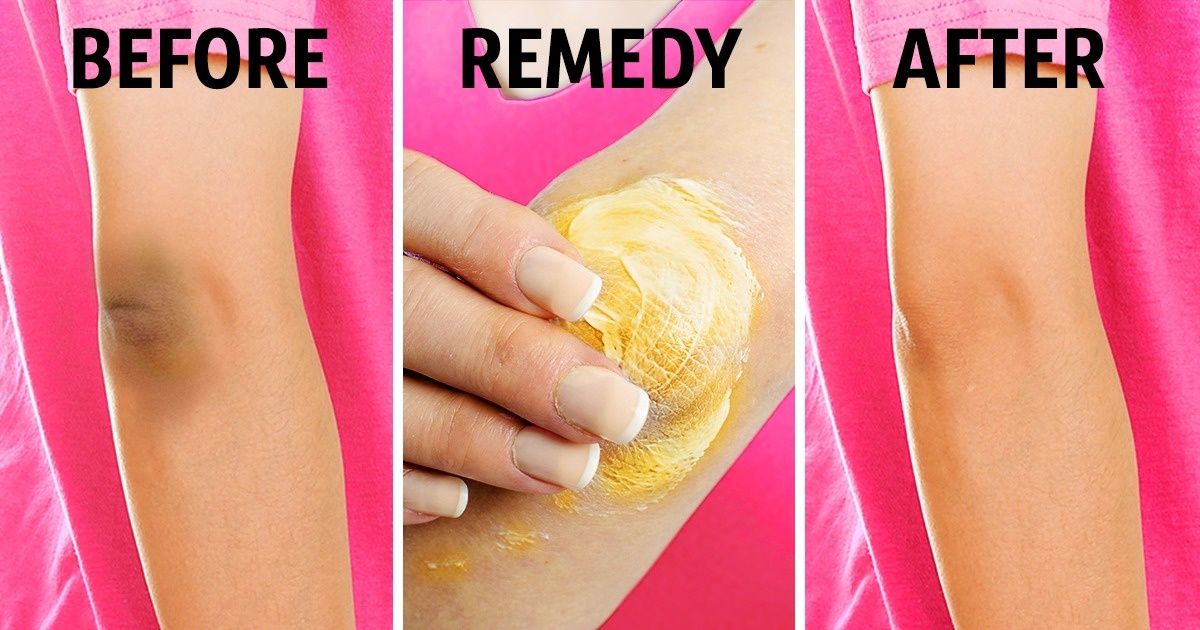 พีคอสเมด Pcosmed ศูนย์รวมโซลูชั่นด้านผิวหนังครบวงจร