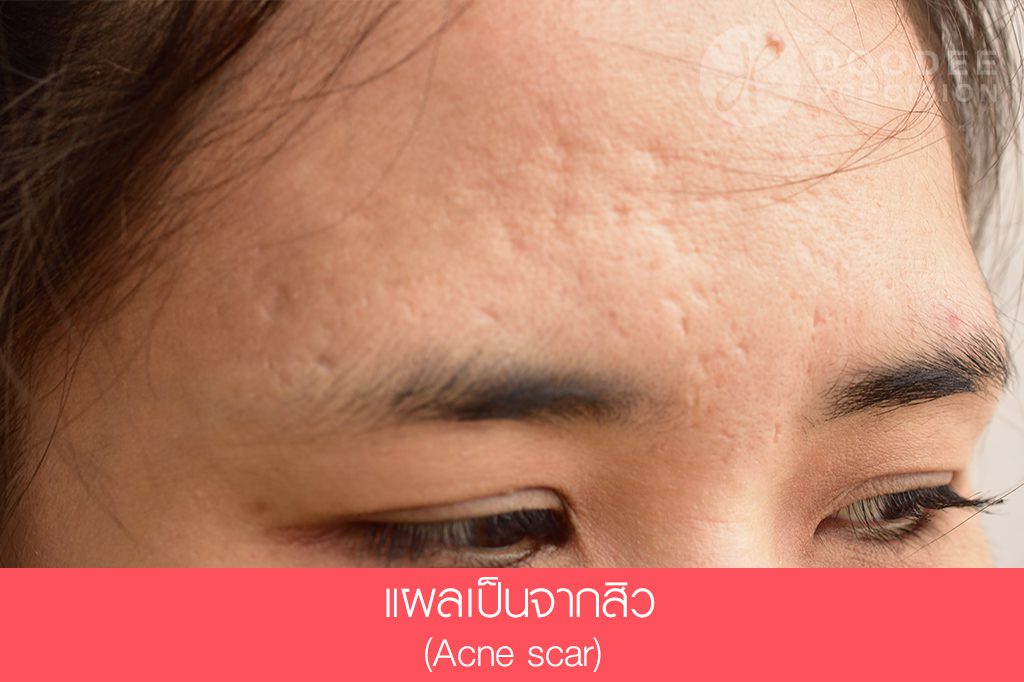 พีคอสเมด Pcosmed ศูนย์รวมโซลูชั่นด้านผิวหนังครบวงจร