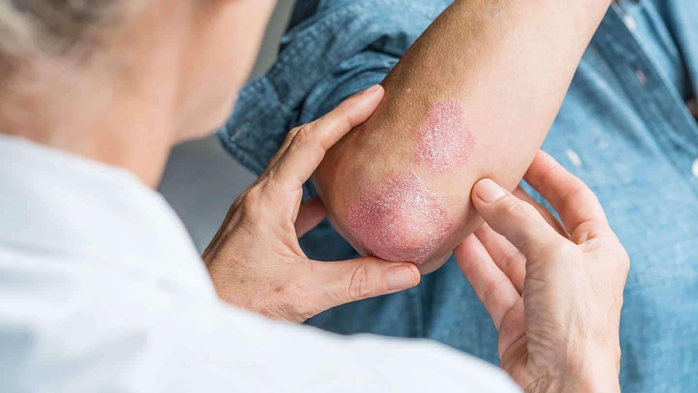 พีคอสเมด Pcosmed ศูนย์รวมโซลูชั่นด้านผิวหนังครบวงจร