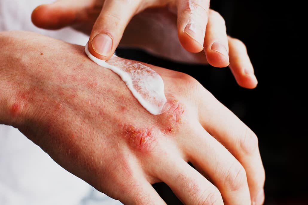 พีคอสเมด Pcosmed ศูนย์รวมโซลูชั่นด้านผิวหนังครบวงจร
