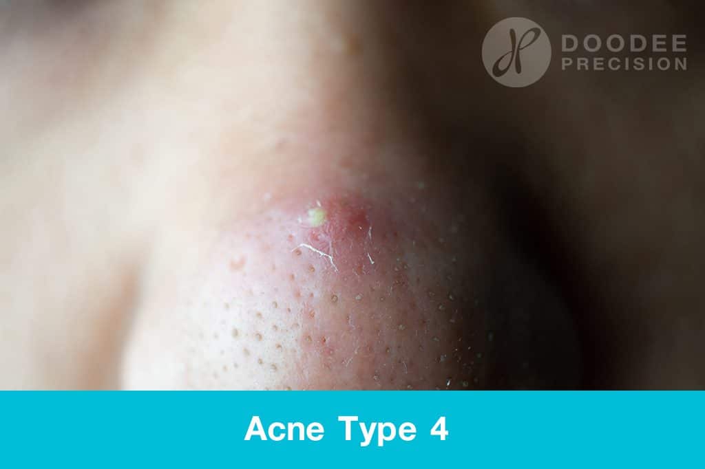 พีคอสเมด Pcosmed ศูนย์รวมโซลูชั่นด้านผิวหนังครบวงจร