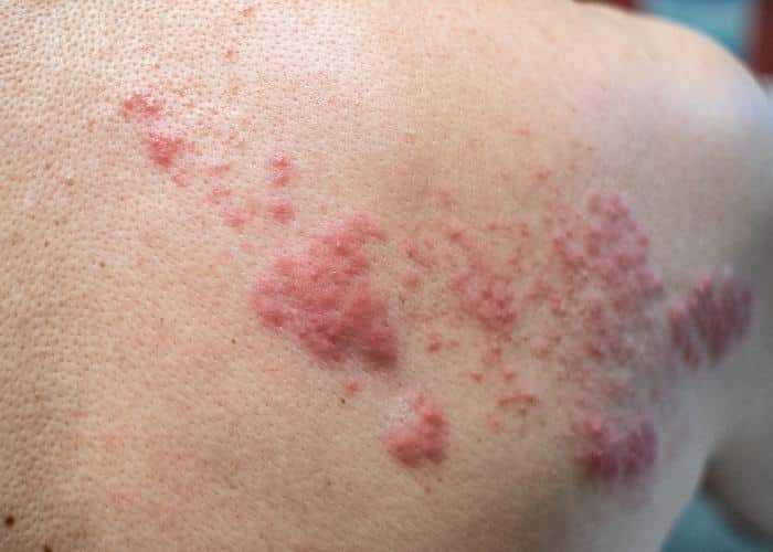 พีคอสเมด Pcosmed ศูนย์รวมโซลูชั่นด้านผิวหนังครบวงจร