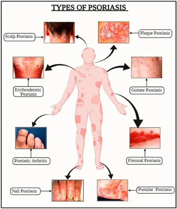 พีคอสเมด Pcosmed ศูนย์รวมโซลูชั่นด้านผิวหนังครบวงจร