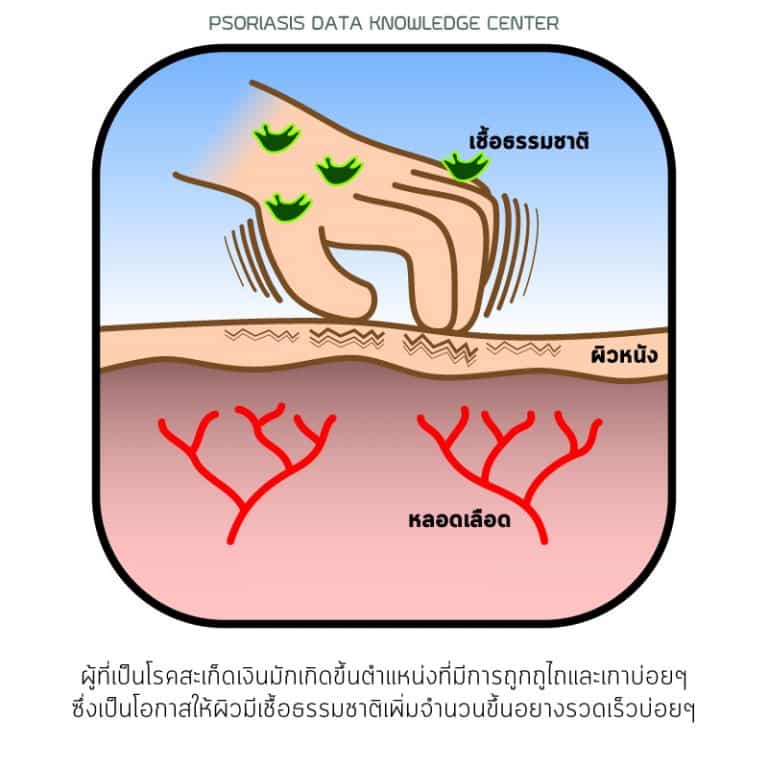 พีคอสเมด Pcosmed ศูนย์รวมโซลูชั่นด้านผิวหนังครบวงจร