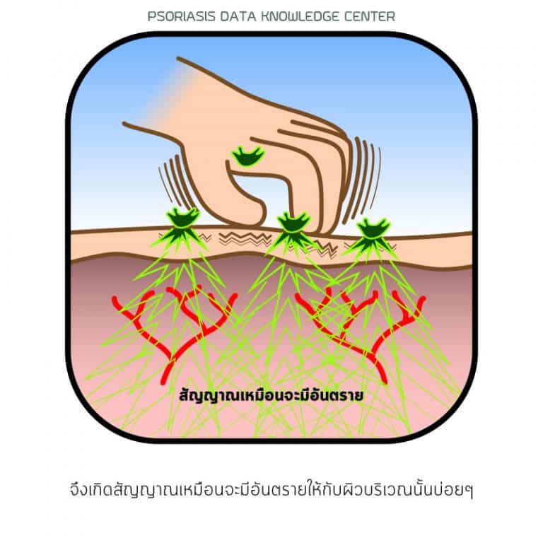 พีคอสเมด Pcosmed ศูนย์รวมโซลูชั่นด้านผิวหนังครบวงจร