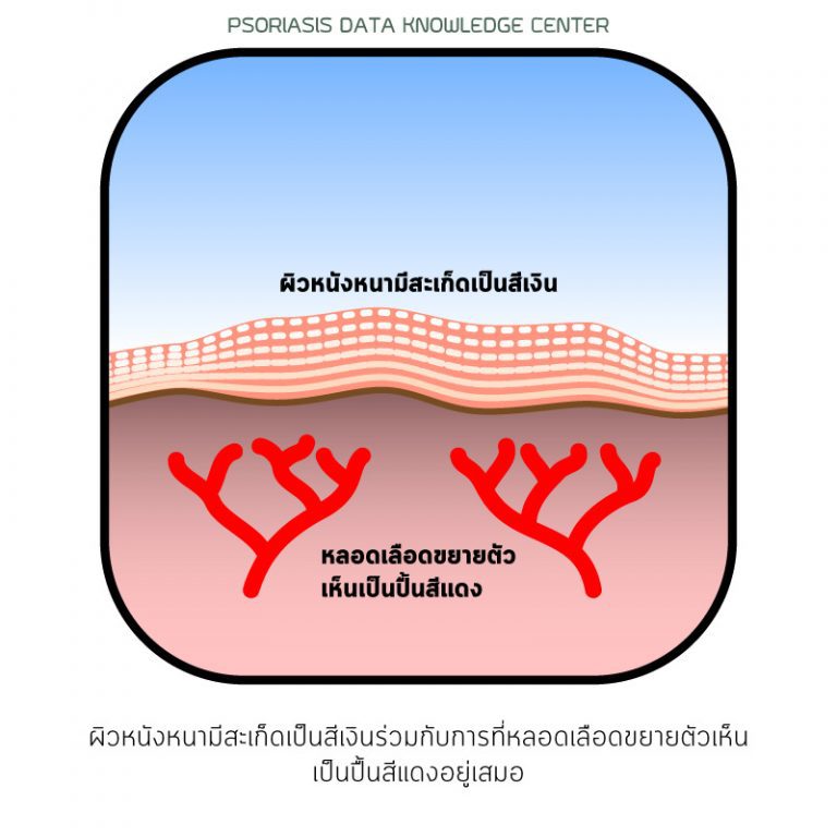 พีคอสเมด Pcosmed ศูนย์รวมโซลูชั่นด้านผิวหนังครบวงจร