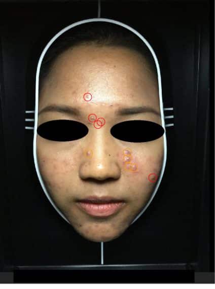 พีคอสเมด Pcosmed ศูนย์รวมโซลูชั่นด้านผิวหนังครบวงจร