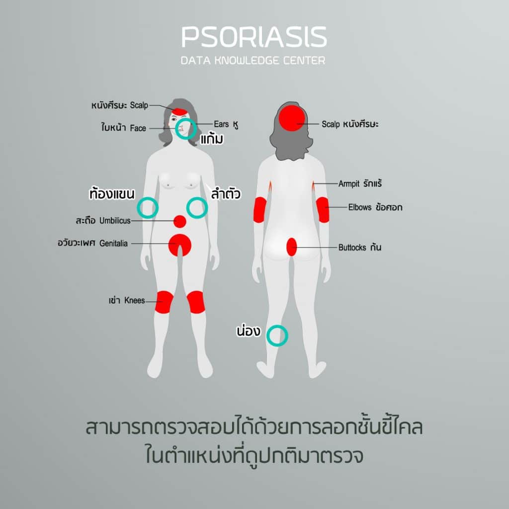 พีคอสเมด Pcosmed ศูนย์รวมโซลูชั่นด้านผิวหนังครบวงจร