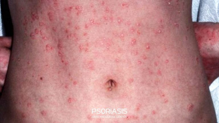 พีคอสเมด Pcosmed ศูนย์รวมโซลูชั่นด้านผิวหนังครบวงจร