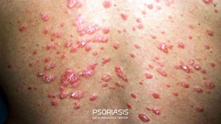 พีคอสเมด Pcosmed ศูนย์รวมโซลูชั่นด้านผิวหนังครบวงจร
