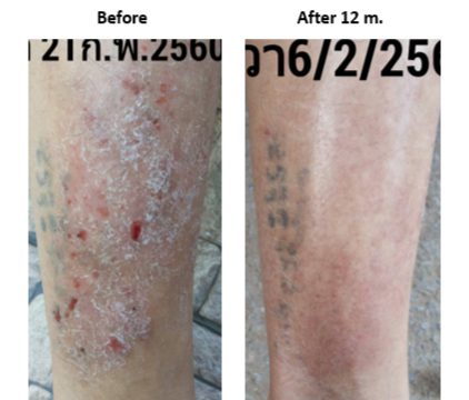 พีคอสเมด Pcosmed ศูนย์รวมโซลูชั่นด้านผิวหนังครบวงจร