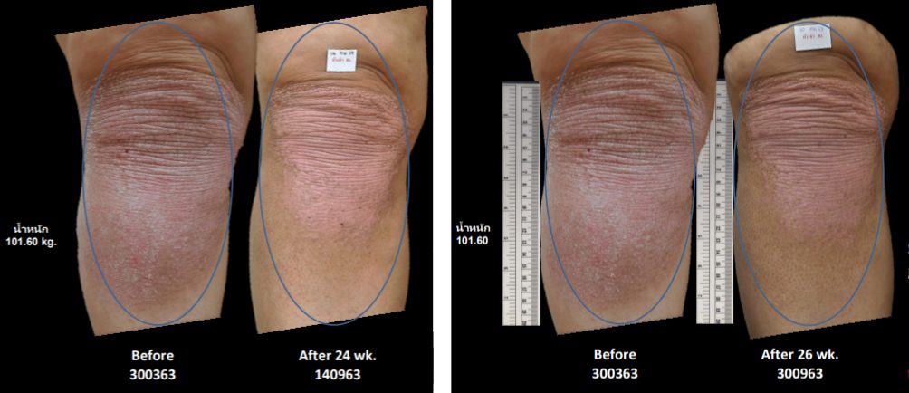 พีคอสเมด Pcosmed ศูนย์รวมโซลูชั่นด้านผิวหนังครบวงจร