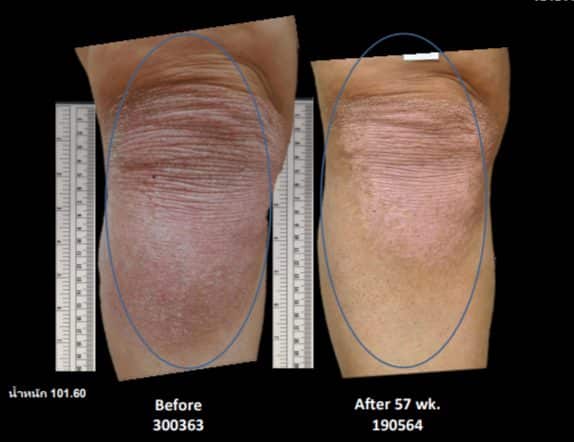 พีคอสเมด Pcosmed ศูนย์รวมโซลูชั่นด้านผิวหนังครบวงจร