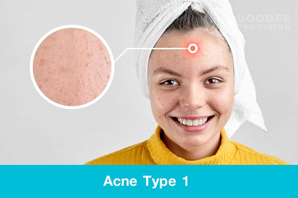 พีคอสเมด Pcosmed ศูนย์รวมโซลูชั่นด้านผิวหนังครบวงจร