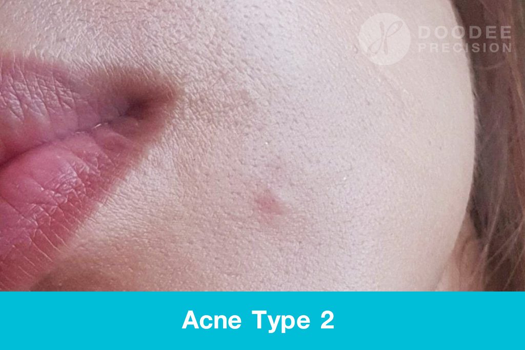 พีคอสเมด Pcosmed ศูนย์รวมโซลูชั่นด้านผิวหนังครบวงจร