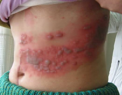 พีคอสเมด Pcosmed ศูนย์รวมโซลูชั่นด้านผิวหนังครบวงจร