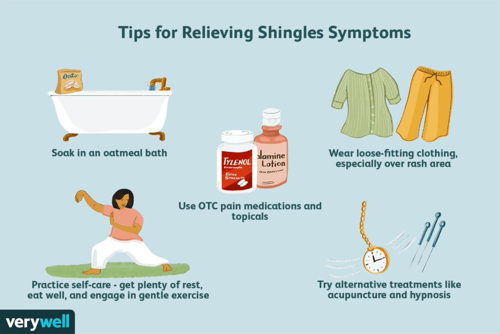 งูสวัด Shingles คำแนะนำสำหรับผู้ป่วยงูสวัด พีคอสเมด Pcosmed ศูนย์รวมโซลูชั่นด้านผิวหนังครบวงจร