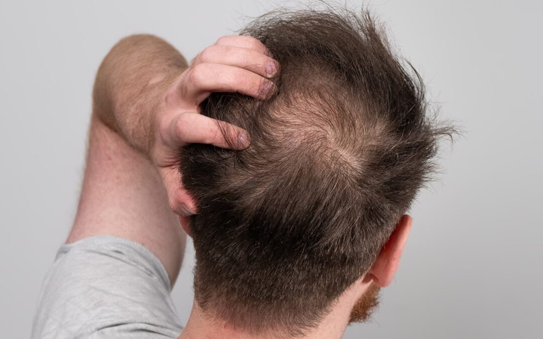 พีคอสเมด Pcosmed ศูนย์รวมโซลูชั่นด้านผิวหนังครบวงจร