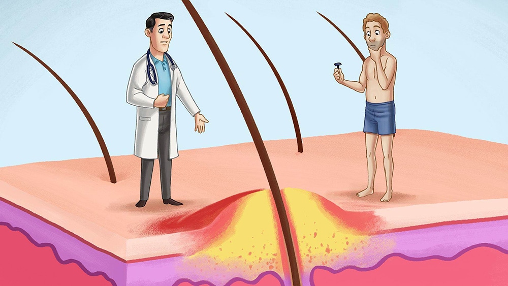 พีคอสเมด Pcosmed ศูนย์รวมโซลูชั่นด้านผิวหนังครบวงจร