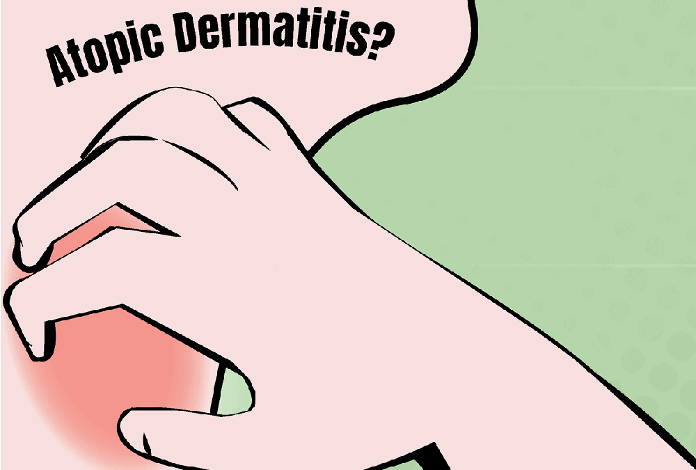 โรคผื่นแพ้อักเสบเรื้อรัง (Atopic dermatitis)