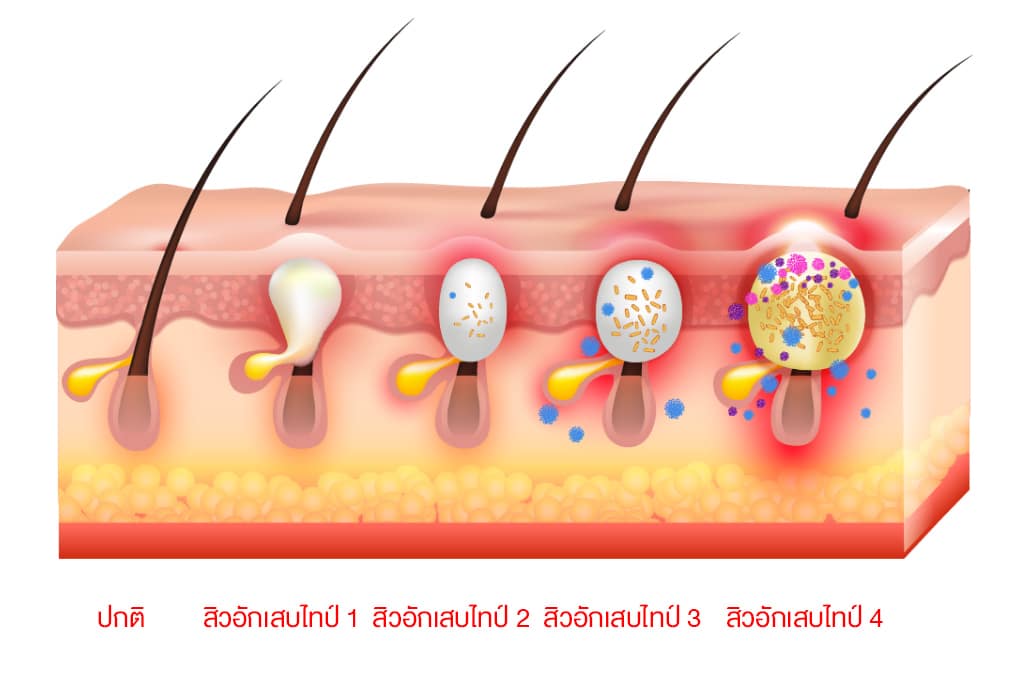 พีคอสเมด Pcosmed ศูนย์รวมโซลูชั่นด้านผิวหนังครบวงจร