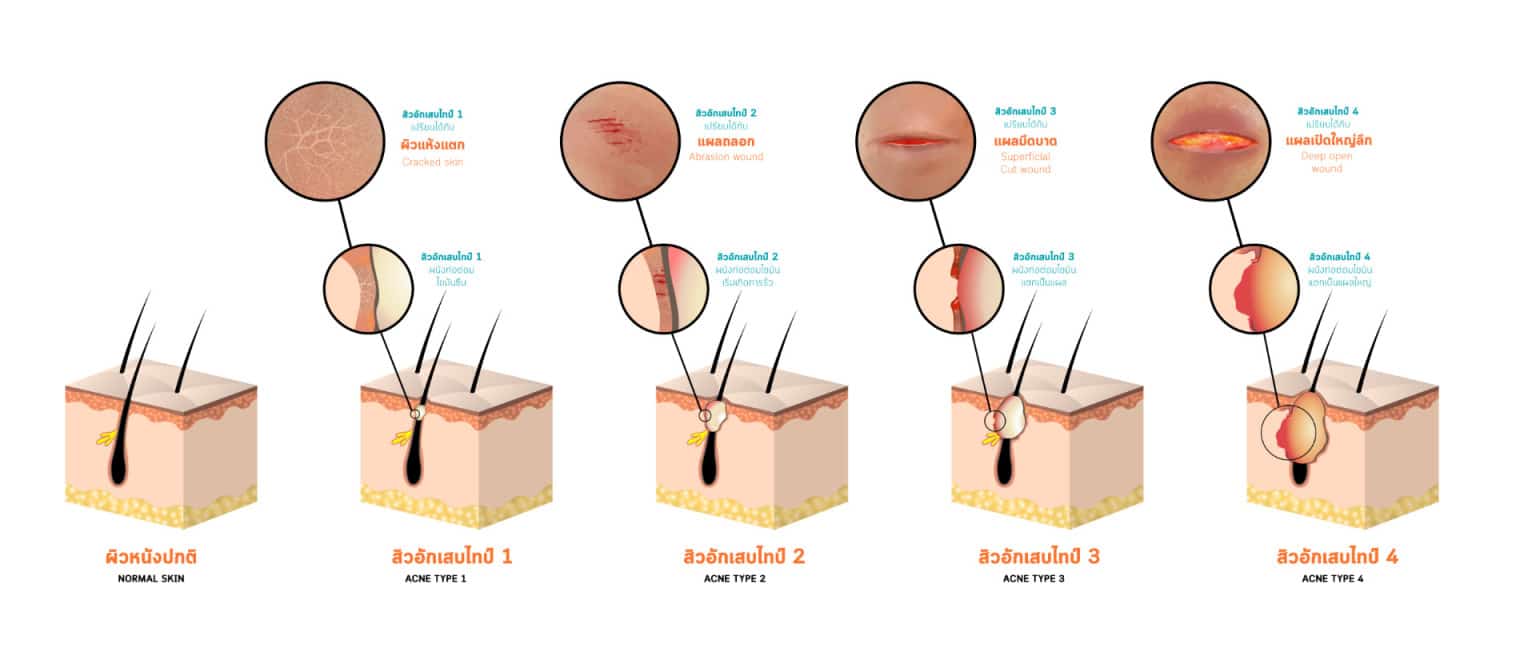 พีคอสเมด Pcosmed ศูนย์รวมโซลูชั่นด้านผิวหนังครบวงจร