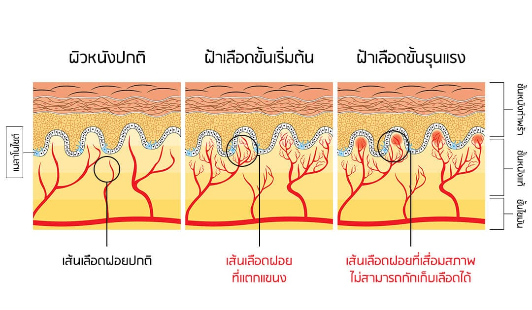 พีคอสเมด Pcosmed ศูนย์รวมโซลูชั่นด้านผิวหนังครบวงจร
