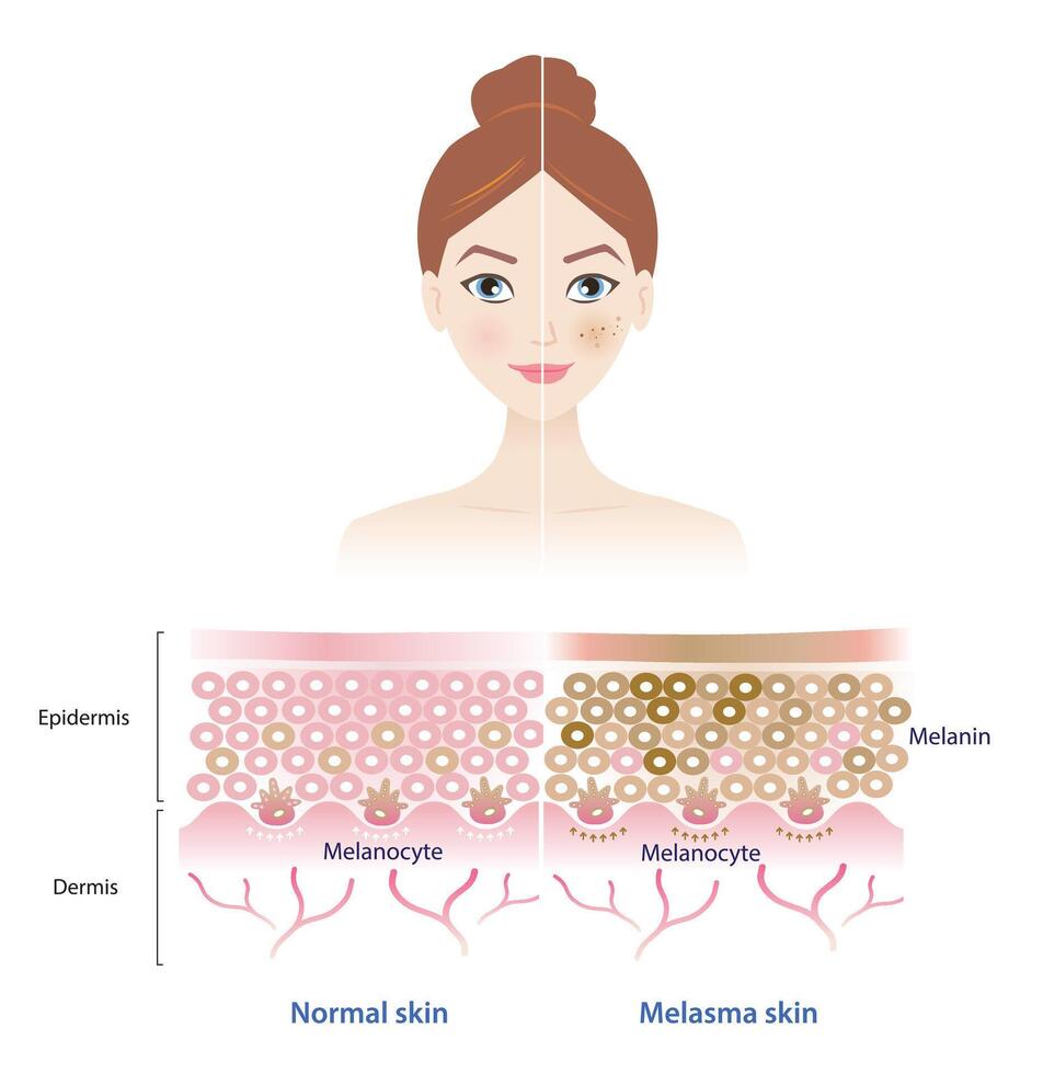 พีคอสเมด Pcosmed ศูนย์รวมโซลูชั่นด้านผิวหนังครบวงจร
