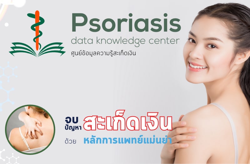 psoriasisbannermb01 พีคอสเมด Pcosmed ศูนย์รวมโซลูชั่นด้านผิวหนังครบวงจร พีคอสเมด Pcosmed ศูนย์รวมโซลูชั่นด้านผิวหนังครบวงจร