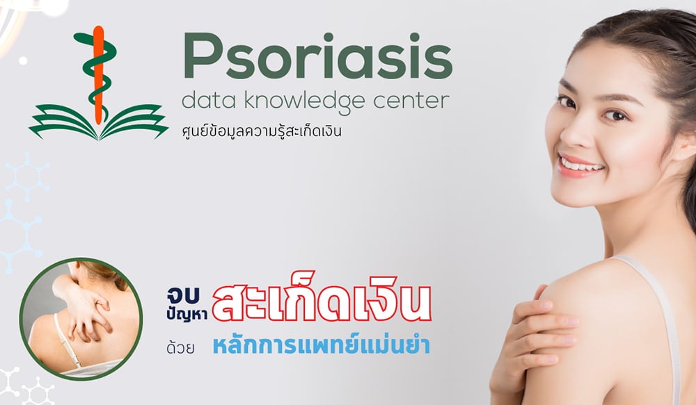 psoriasisguru02 พีคอสเมด Pcosmed ศูนย์รวมโซลูชั่นด้านผิวหนังครบวงจร พีคอสเมด Pcosmed ศูนย์รวมโซลูชั่นด้านผิวหนังครบวงจร