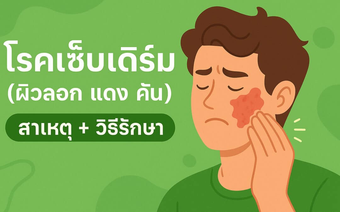โรคเซ็บเดิร์ม (ผิวลอก แดง คัน): สาเหตุ + วิธีรักษา