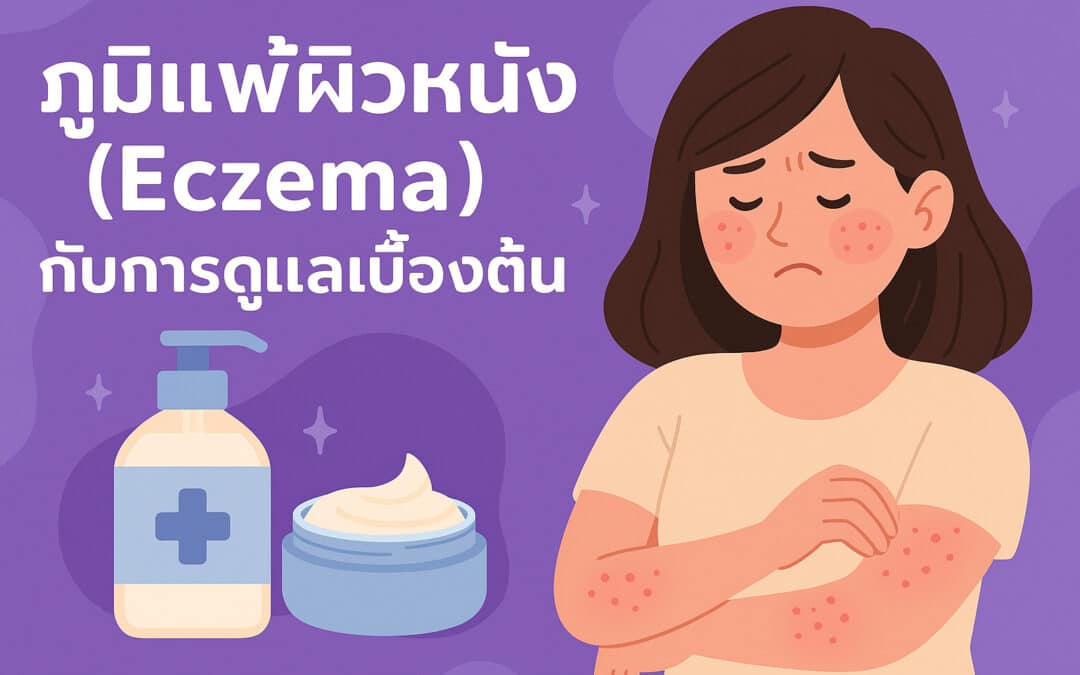 ภูมิแพ้ผิวหนัง (Eczema) กับการดูแลเบื้องต้น