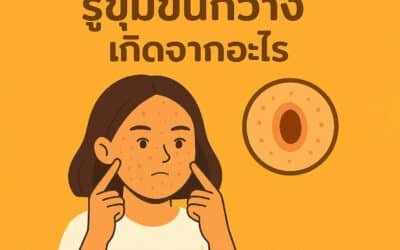 รูขุมขนกว้างเกิดจากอะไร