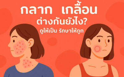 กลาก เกลื้อน ต่างกันยังไง? ดูให้เป็น รักษาให้ถูก