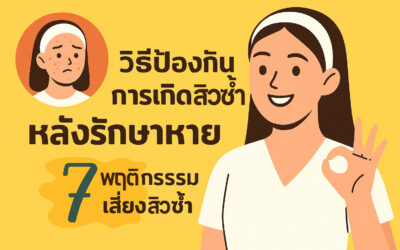 วิธีป้องกันการเกิดสิวซ้ำหลังรักษาหาย