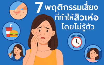 7 พฤติกรรมเสี่ยงที่ทำให้สิวเห่อโดยไม่รู้ตัว