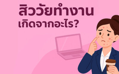 สิววัยทำงานเกิดจากอะไร? ปรับไลฟ์สไตล์อย่างไรให้ผิวกลับมาใส